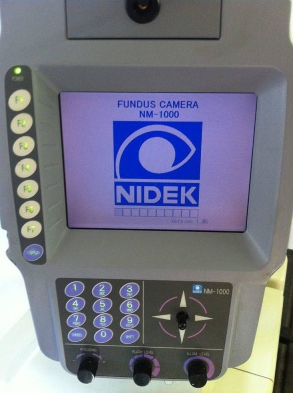 Nidek NM-1000 Fundus Camera Non-Mydriatic