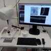 Optovue iFusion 80