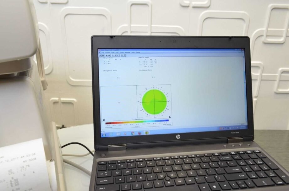 Topcon KR-8000PA Autorefractor/Keratometer/Topographer computerized with 3D